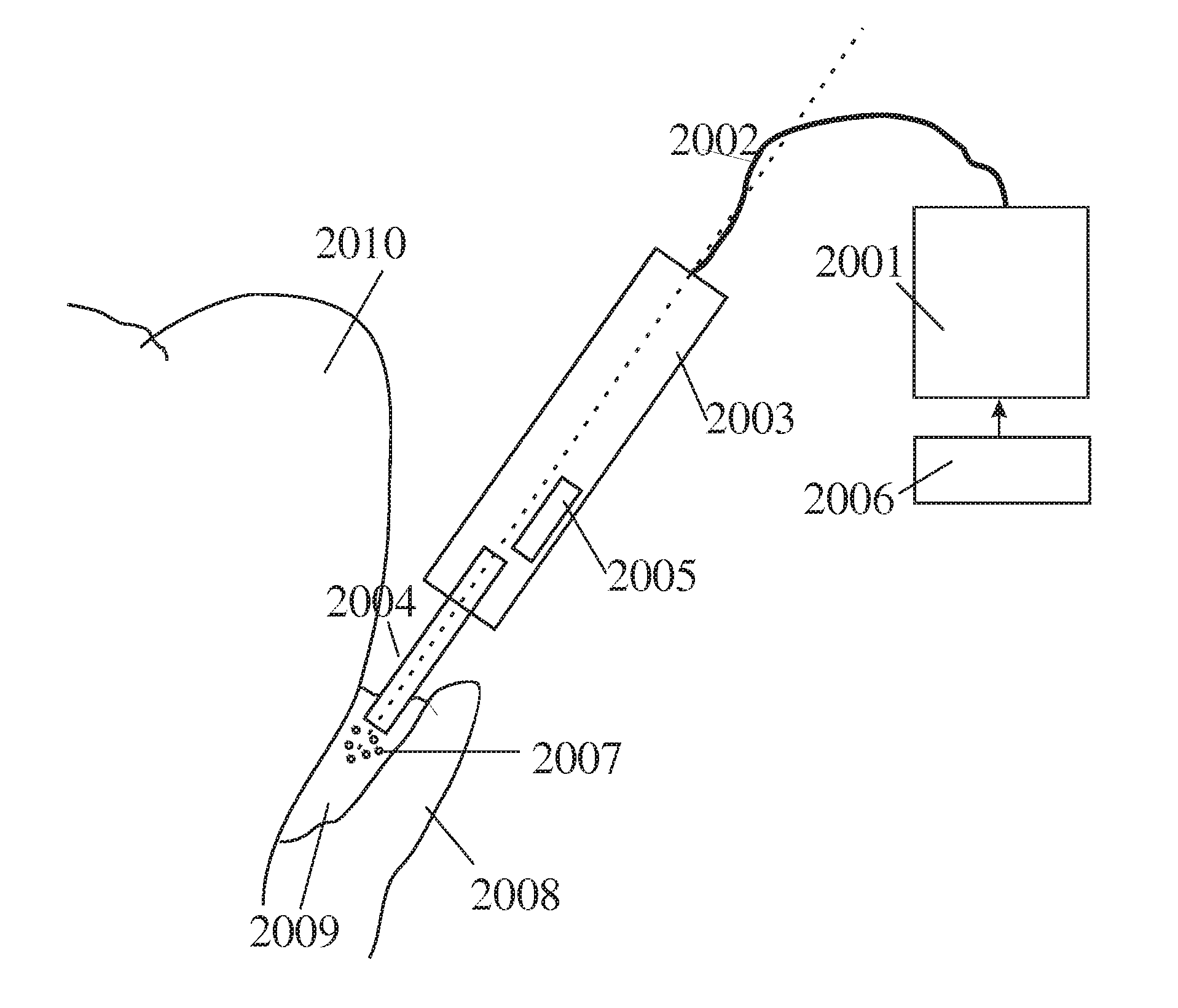 Dental surgical laser with feedback mechanisms