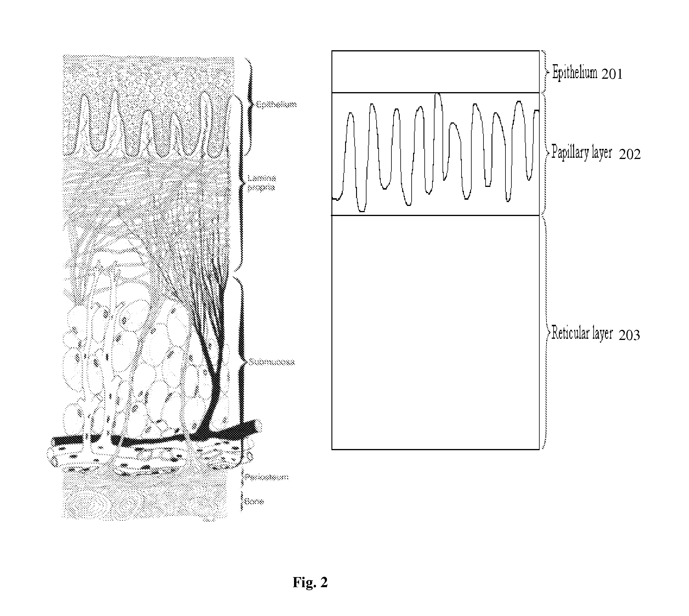 Dental surgical laser with feedback mechanisms