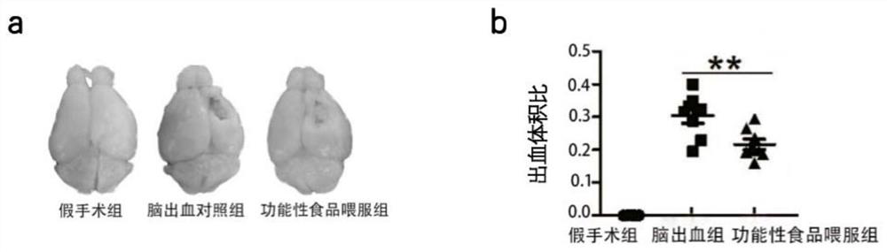 Functional formula food and application thereof in preparation of medicine for preventing and treating secondary brain injury after cerebral hemorrhage