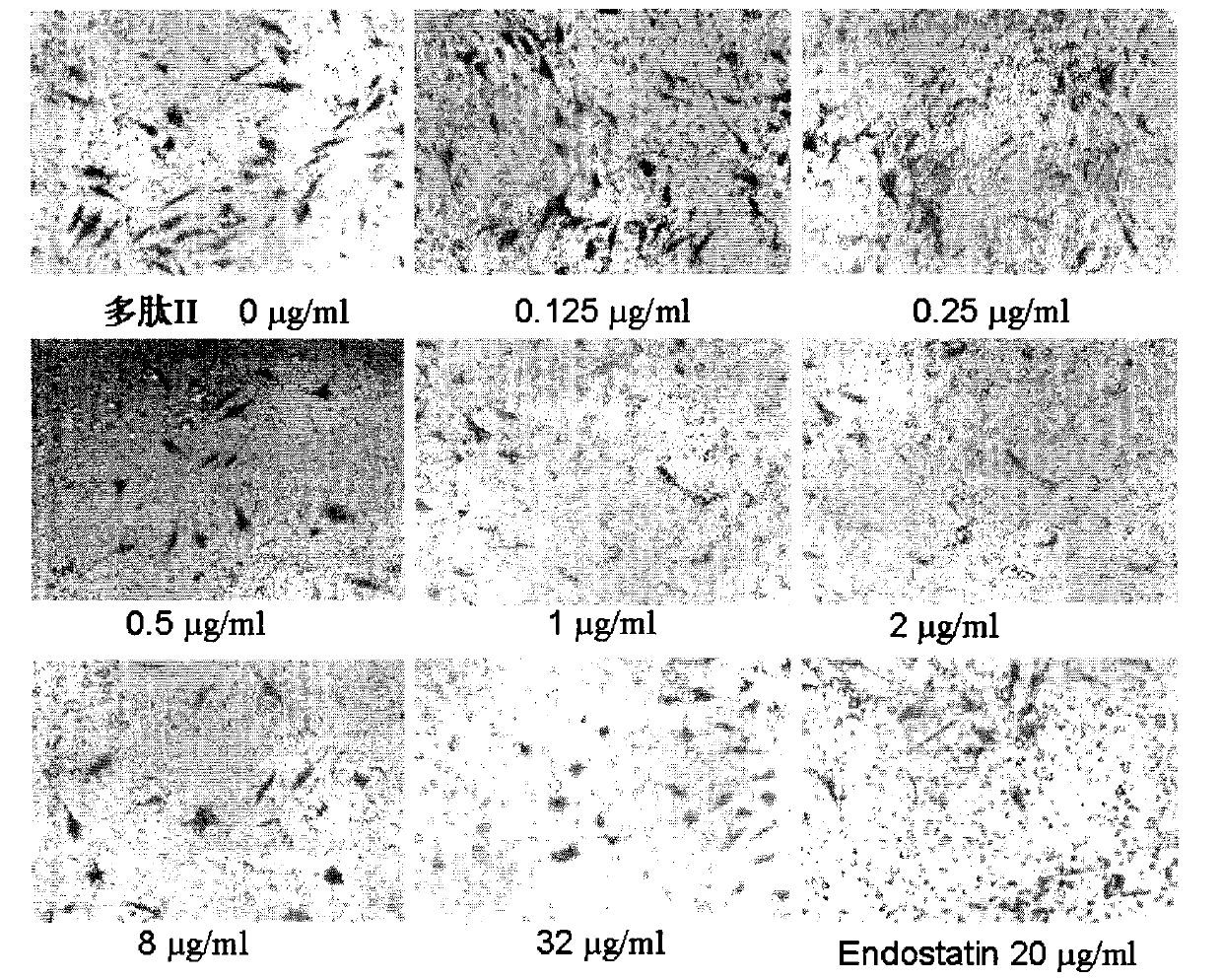 Application of angiogenesis inhibitor polypeptide to preparation of medicine for treating tumor and rheumatoid arthritis