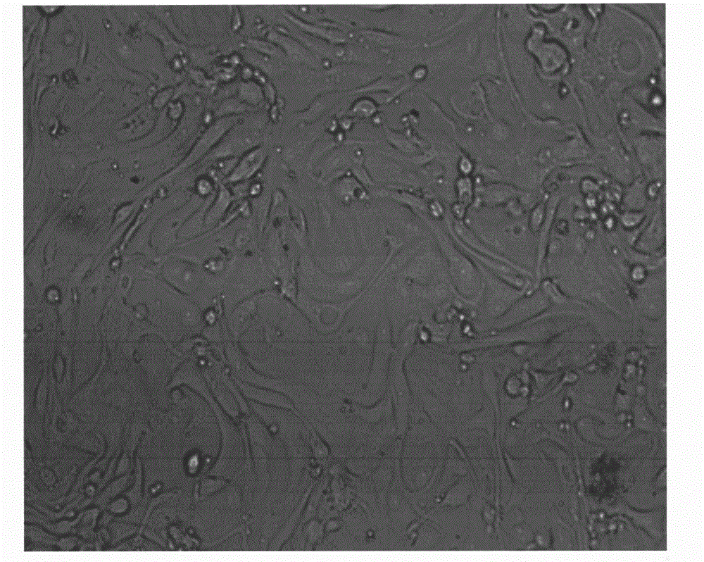 Diagnosis quality-control cell strain for common numerical abnormalities of chromosomes and preparation method thereof