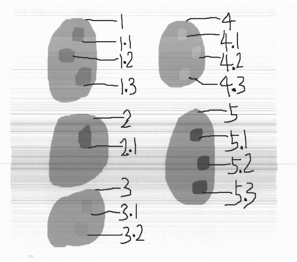 Diagnosis quality-control cell strain for common numerical abnormalities of chromosomes and preparation method thereof