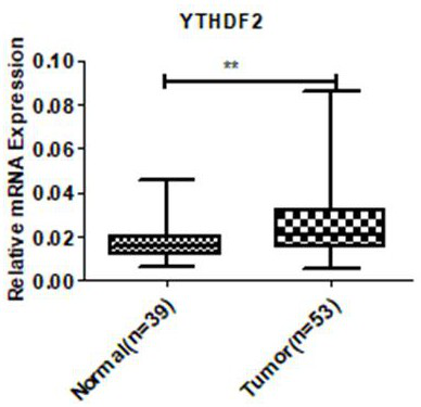 Application of ythdf2 gene in diagnosis, prevention and treatment of urothelial carcinoma