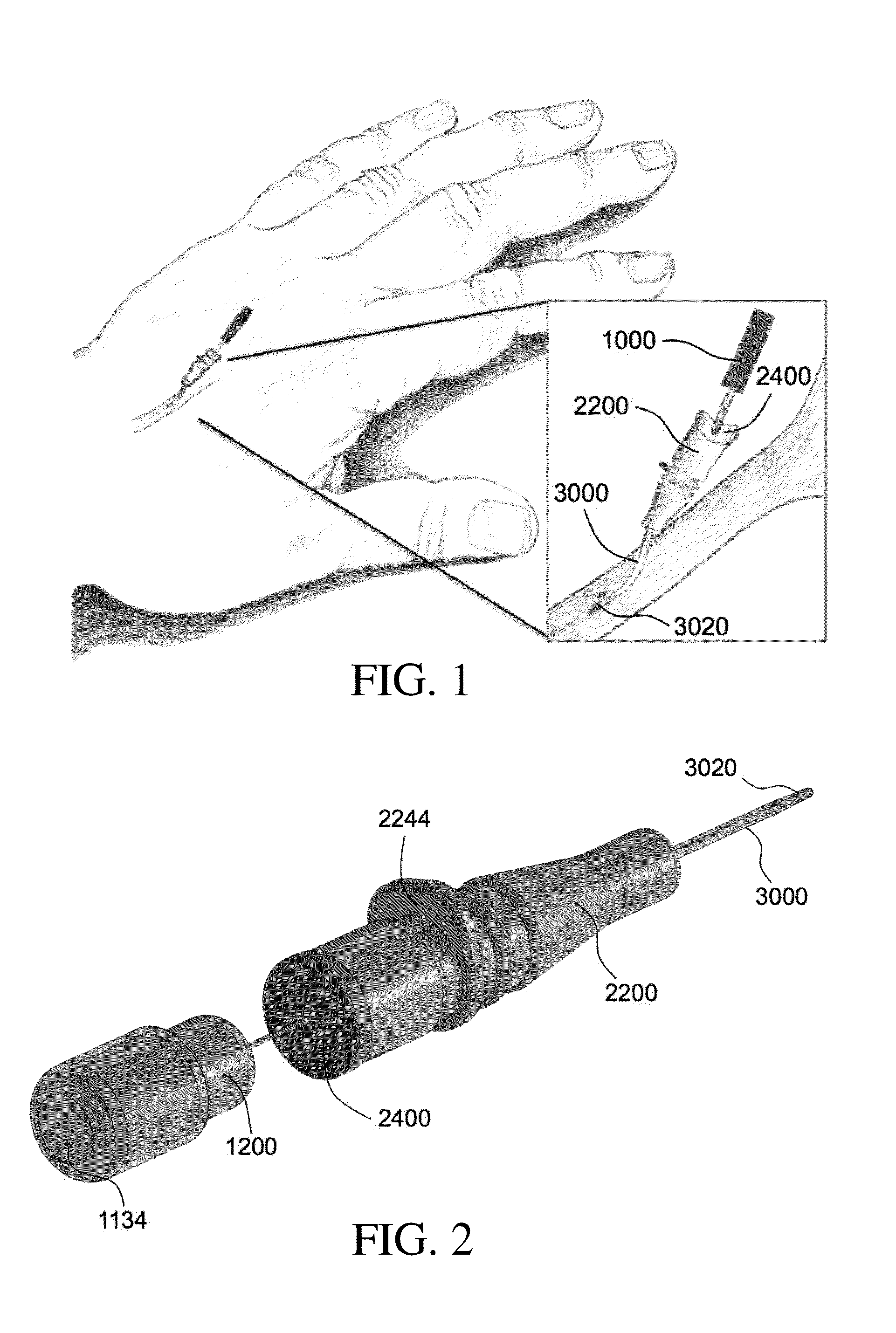 Vascular blood sampling catheter