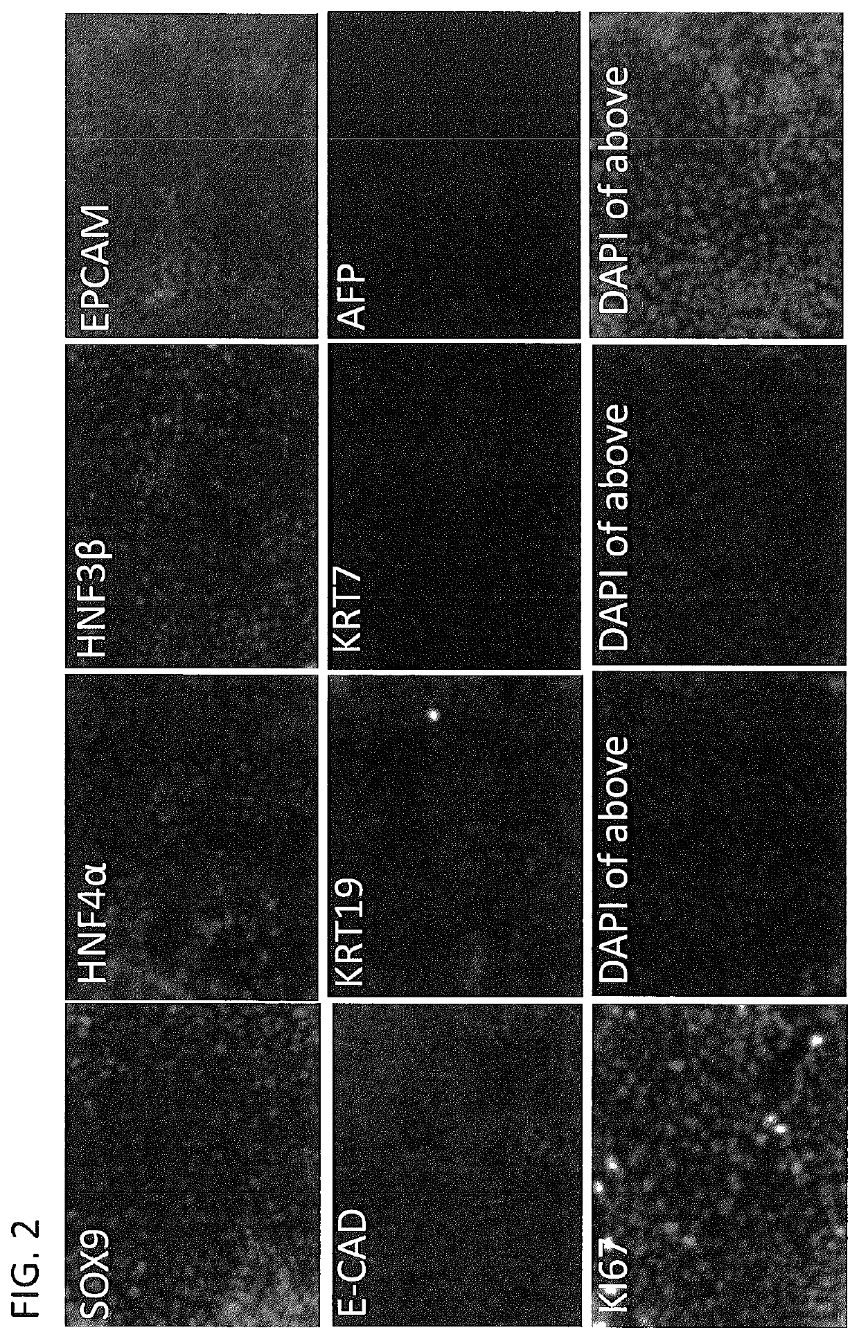 Derivation of hepatic stem cells and mature liver cell types and uses thereof