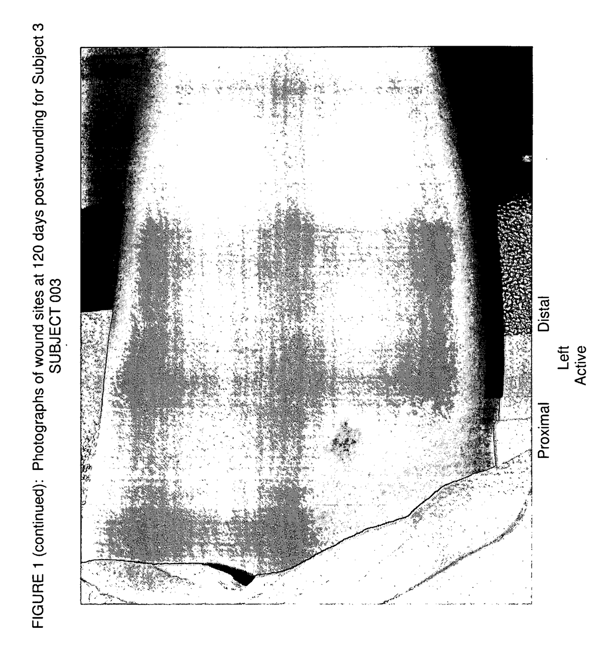 Prophylactic normalization of cutaneous wound repair