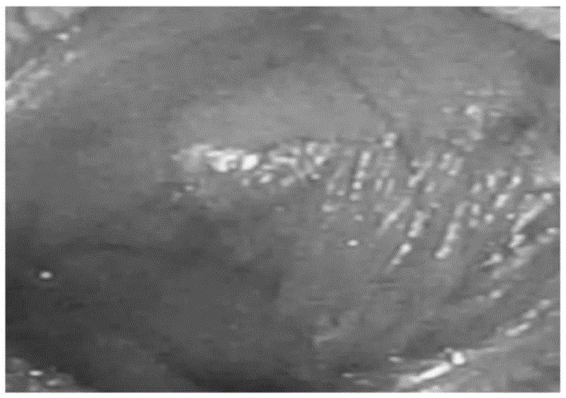 Novel application of acetylcysteine