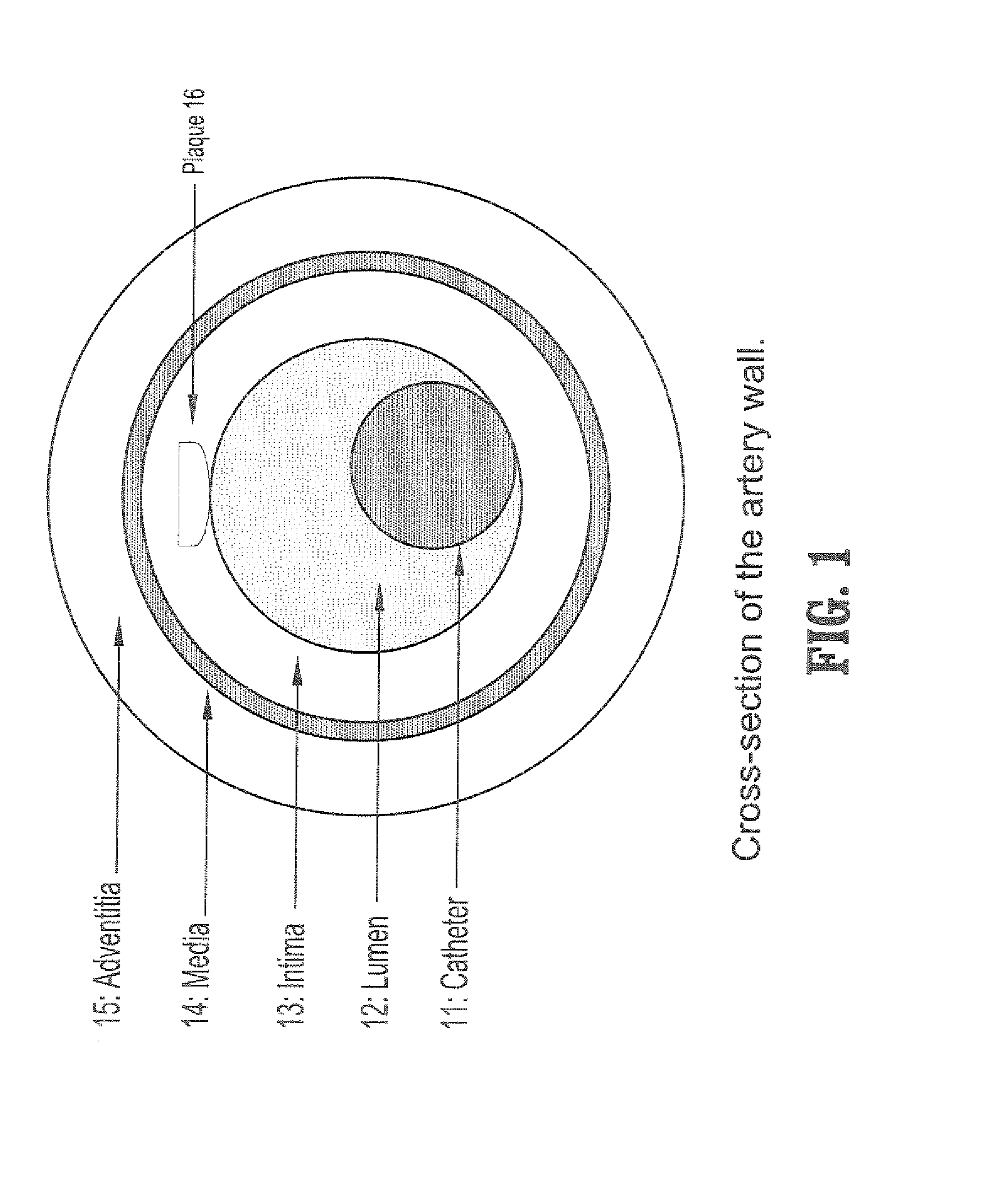 System and method for statistical shape model based segmentation of intravascular ultrasound and optical coherence tomography images