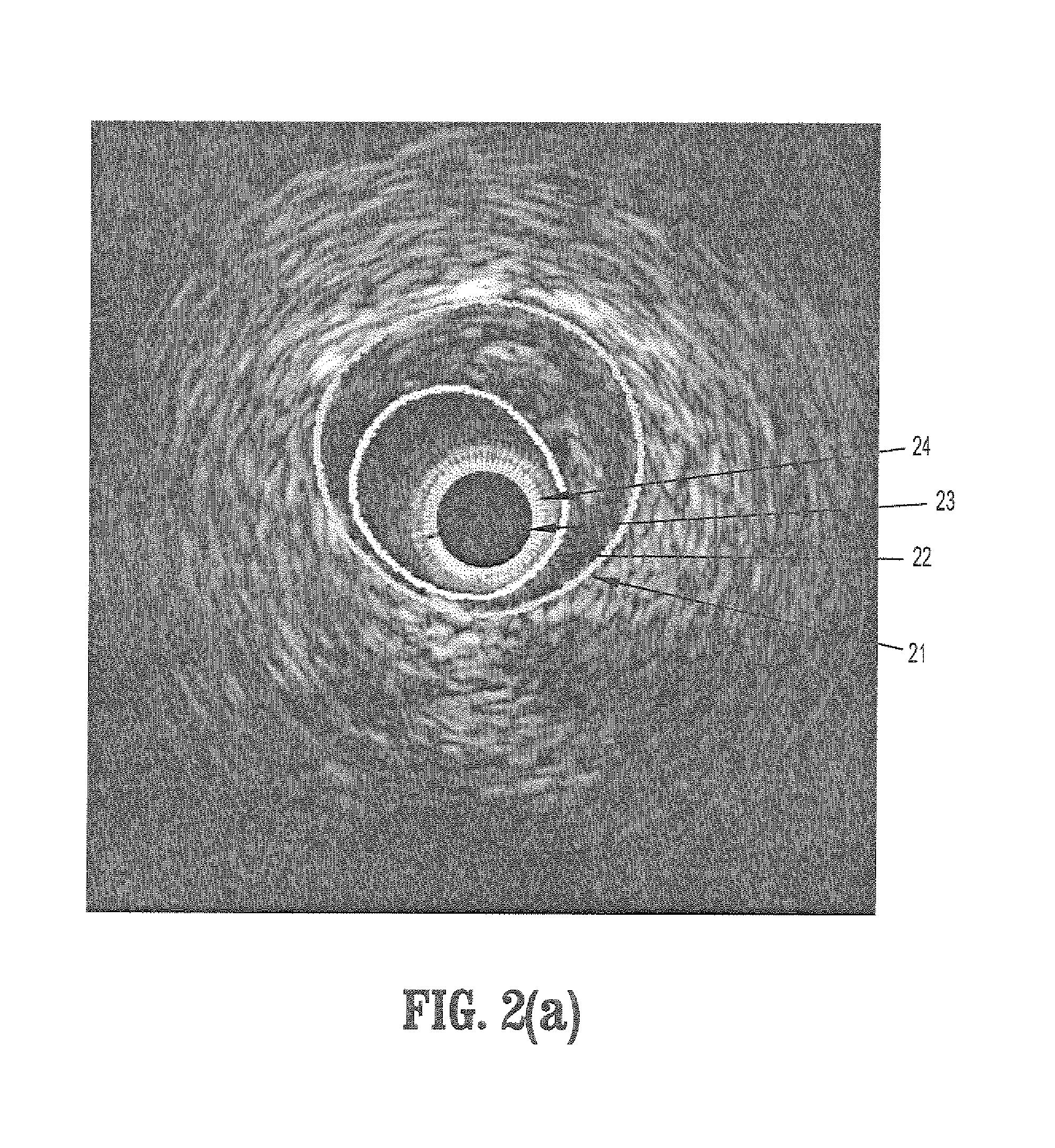 System and method for statistical shape model based segmentation of intravascular ultrasound and optical coherence tomography images