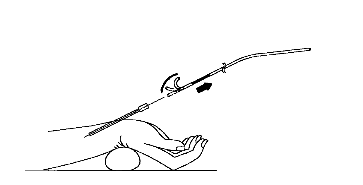 Super-smooth guide wire for use in transradial coronary intervention