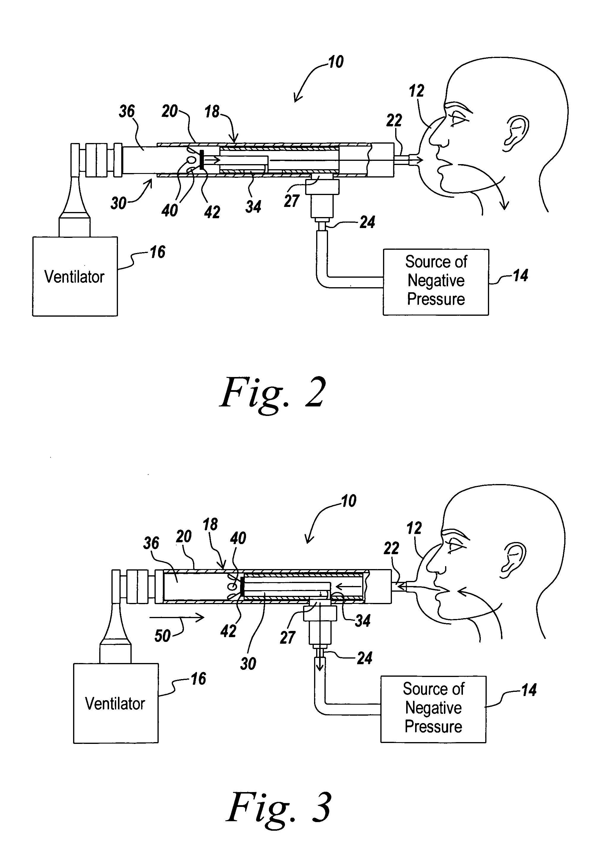 Inexsufflator