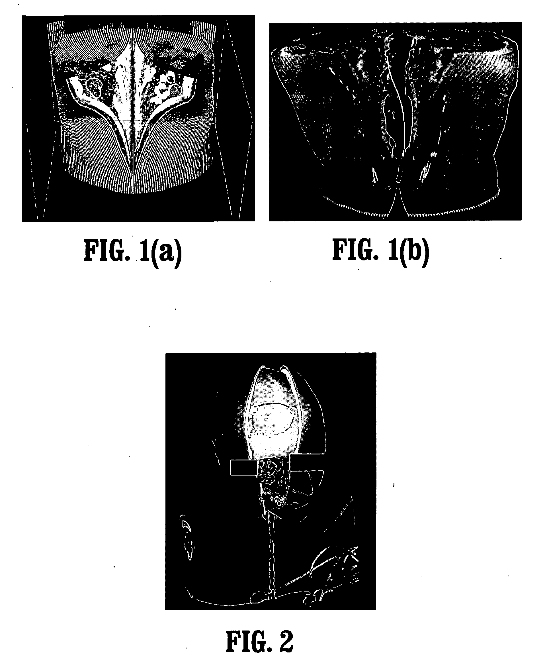 System and method for in-context volume visualization using virtual incision