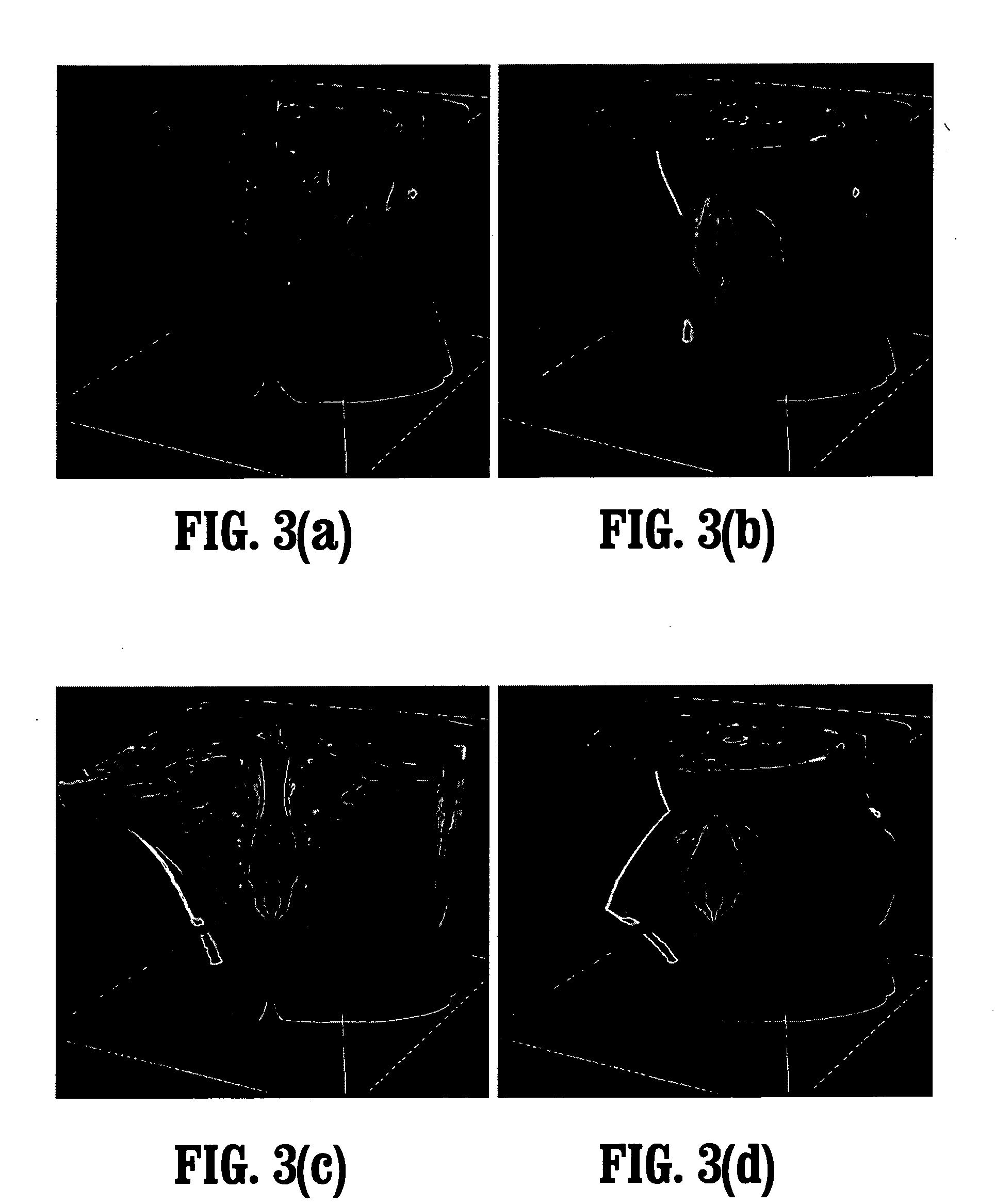 System and method for in-context volume visualization using virtual incision