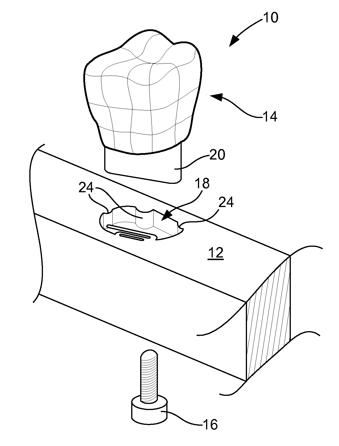 Dental models and related methods