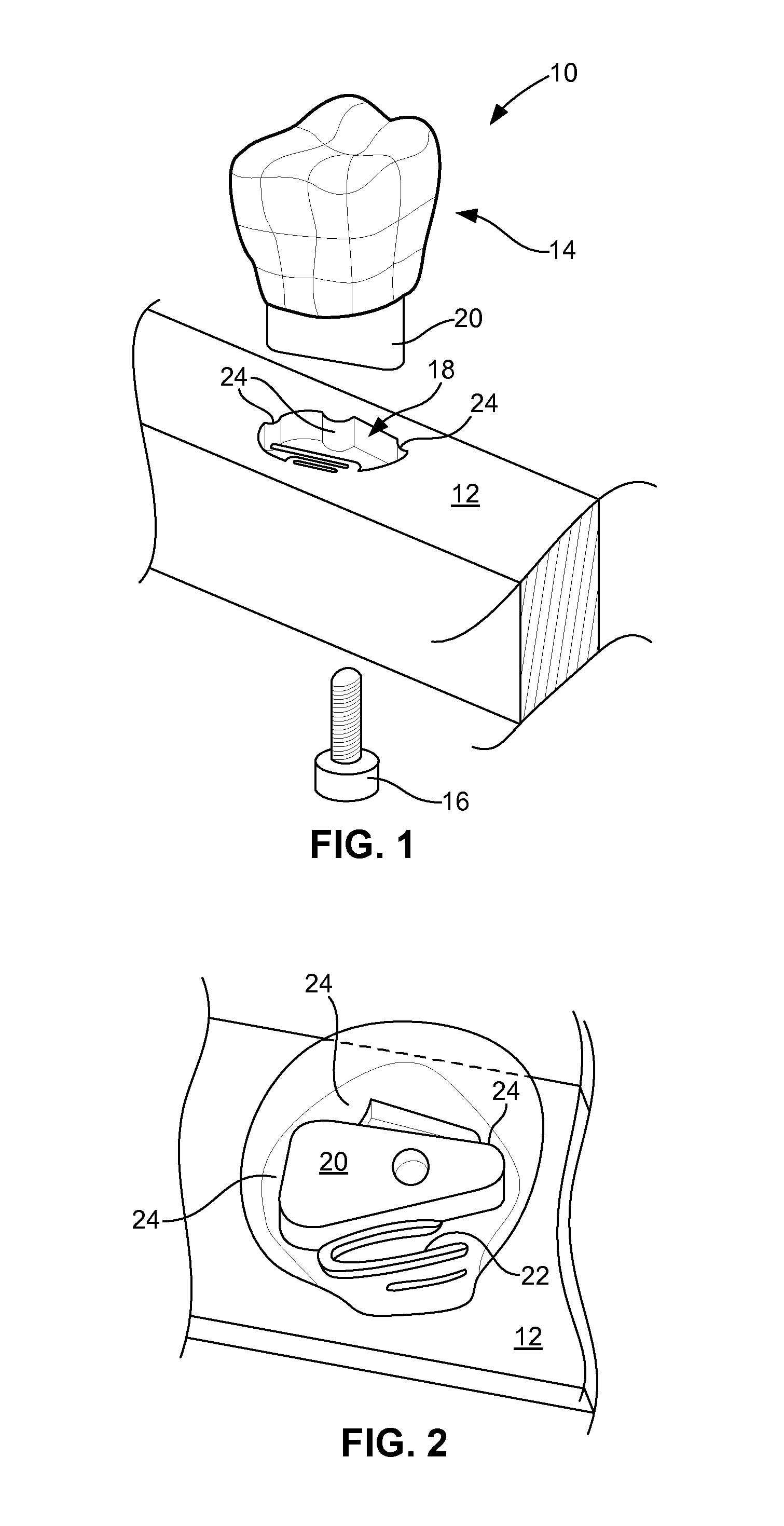 Dental models and related methods