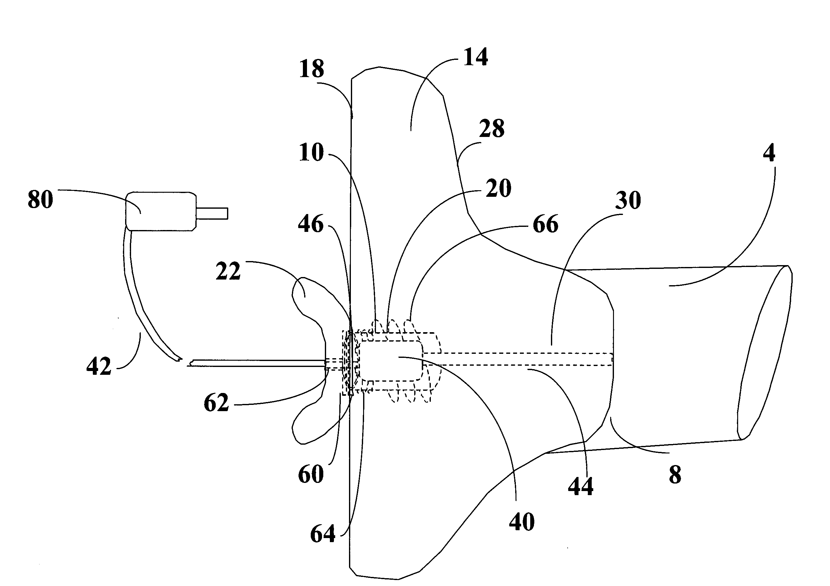 Instant custom ear mold with removable receiver insert for auditory devices