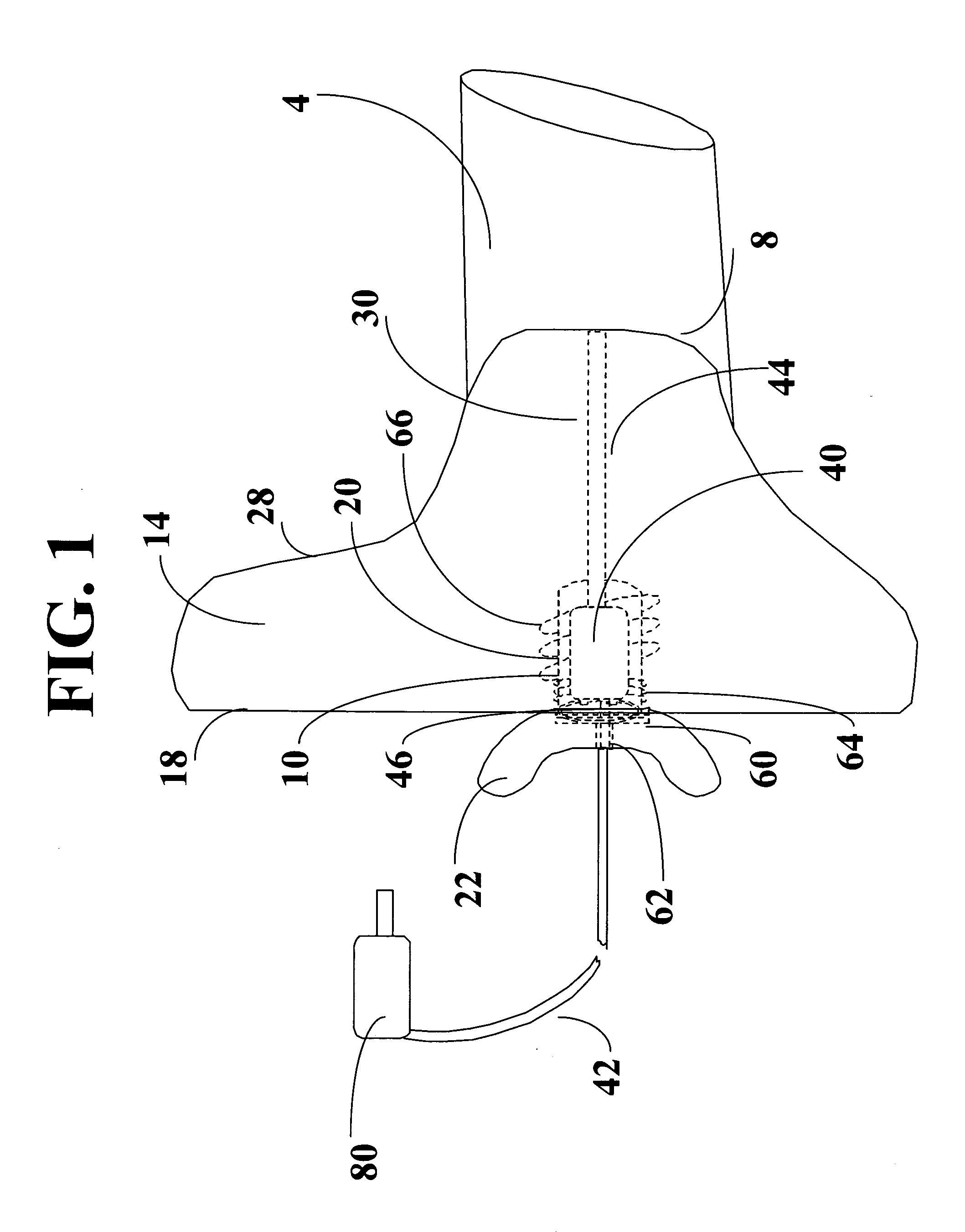 Instant custom ear mold with removable receiver insert for auditory devices