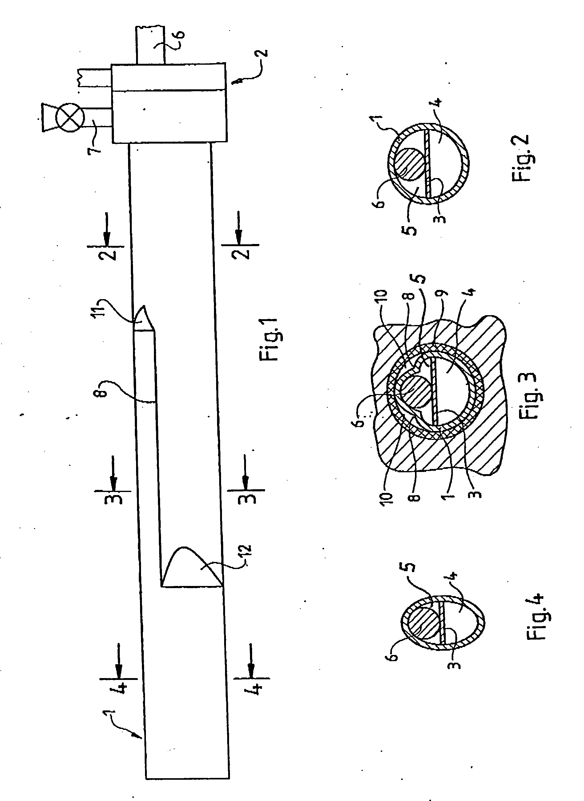 Ureteroscope having a stem