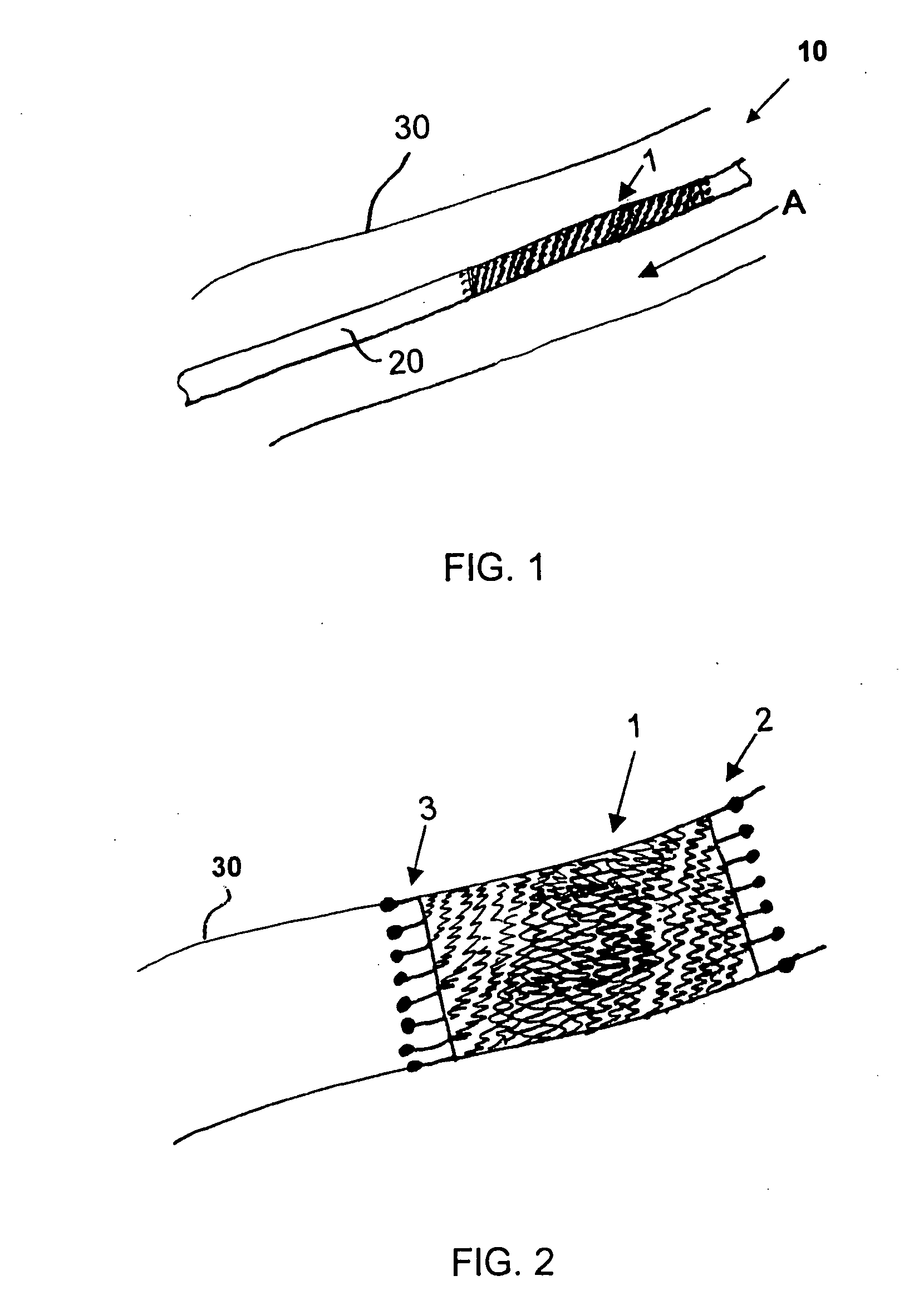 Stent and method for manufacturing the stent