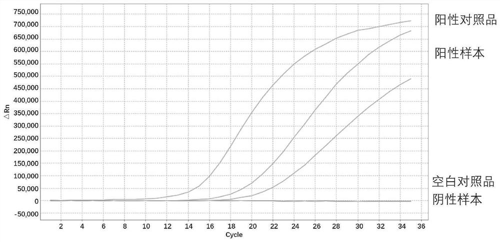 Biomarker for thyroid nodule benign and malignant discrimination, multi-gene joint detection kit and application