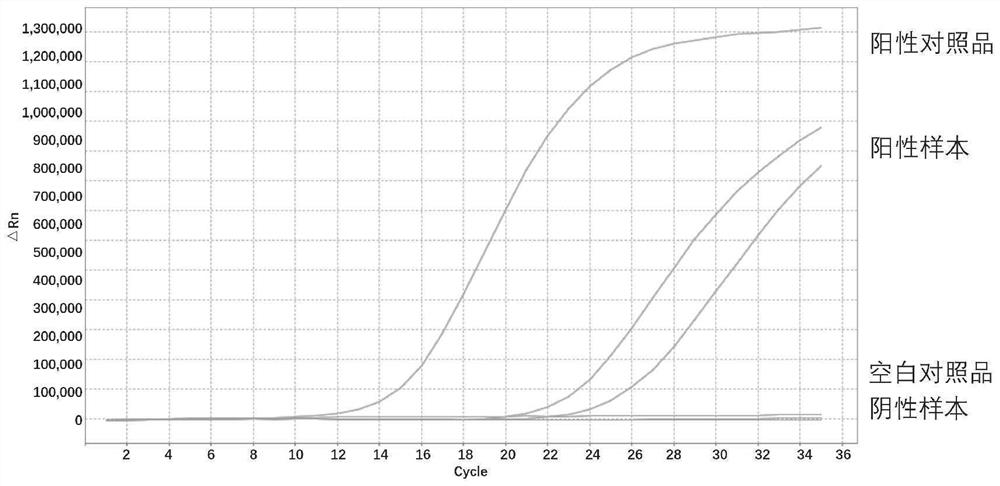 Biomarker for thyroid nodule benign and malignant discrimination, multi-gene joint detection kit and application