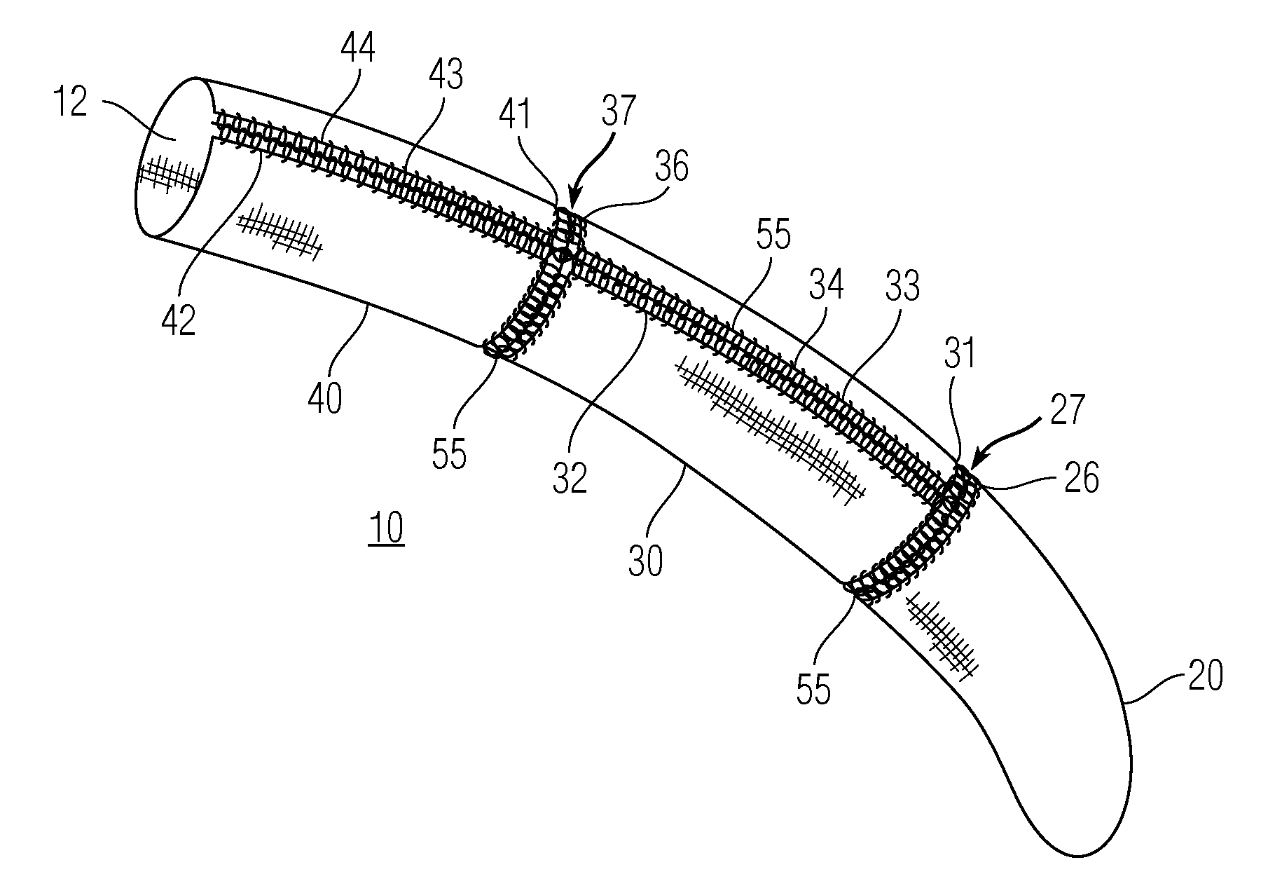 Drapes with Circumferential and Longitudinal Breakaways