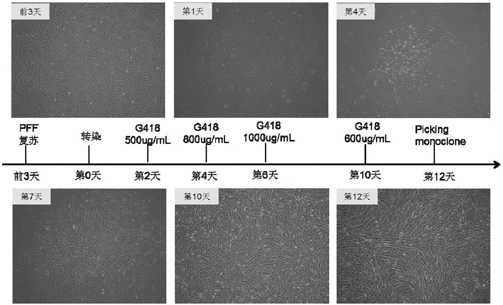 CD28 gene overexpression vector and application thereof