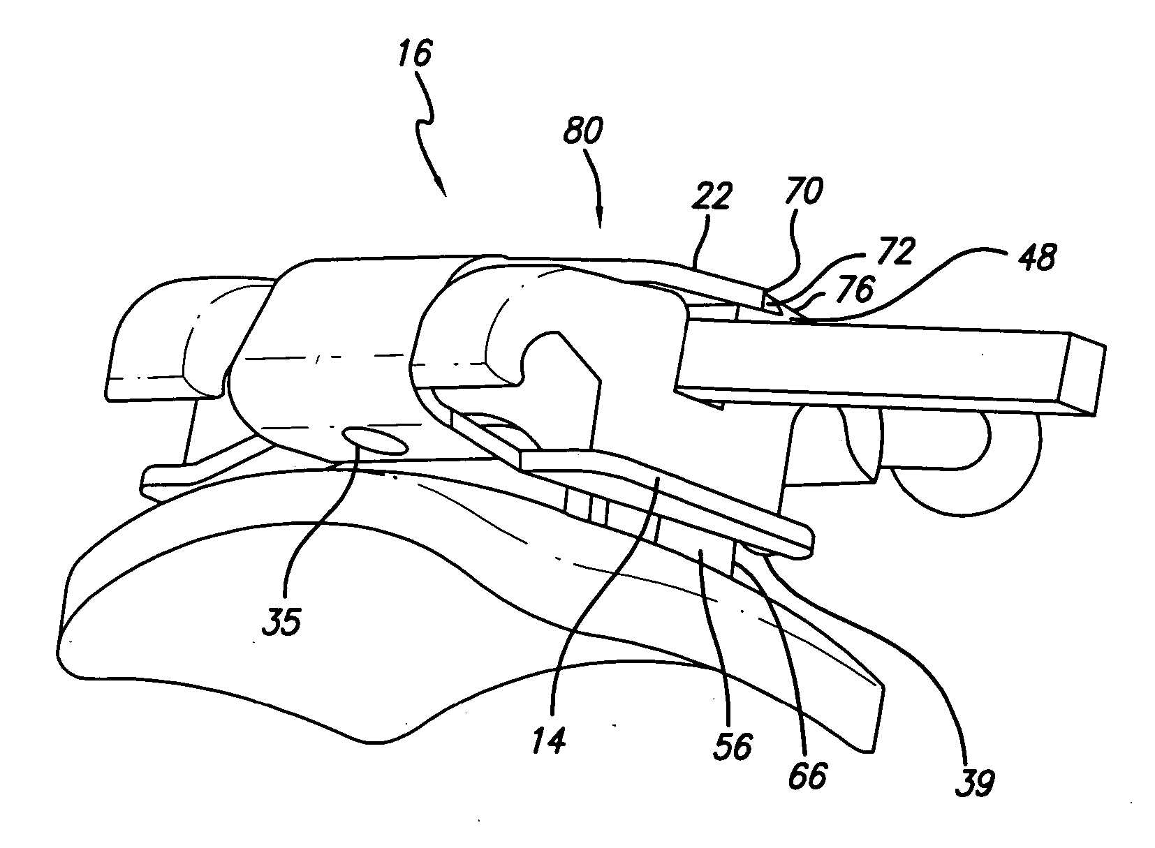 Low profile self-ligating bracket assembly and method of use