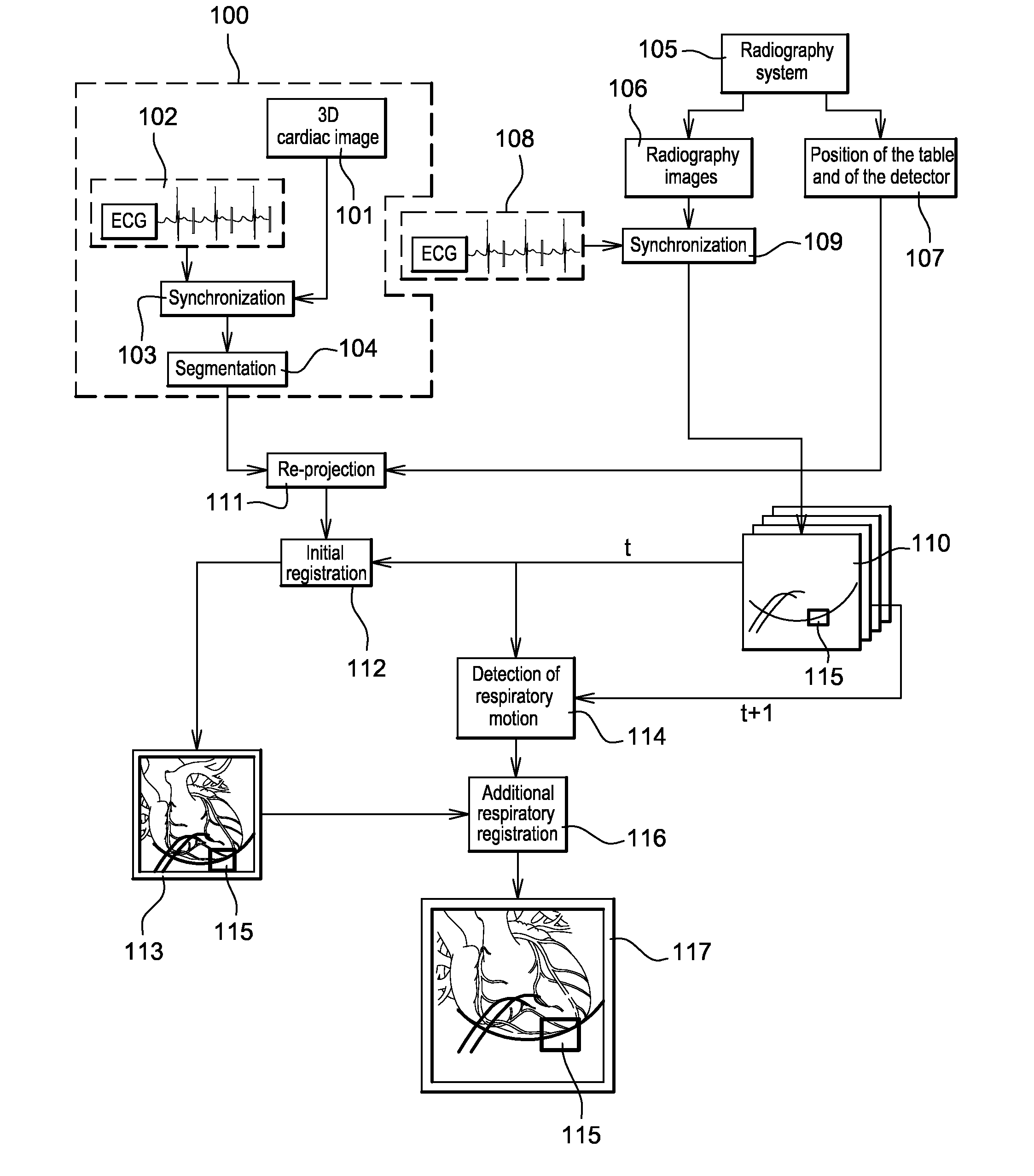 Method of detection and compensation for respiratory motion in radiography cardiac images synchronized with an electrocardiogram signal