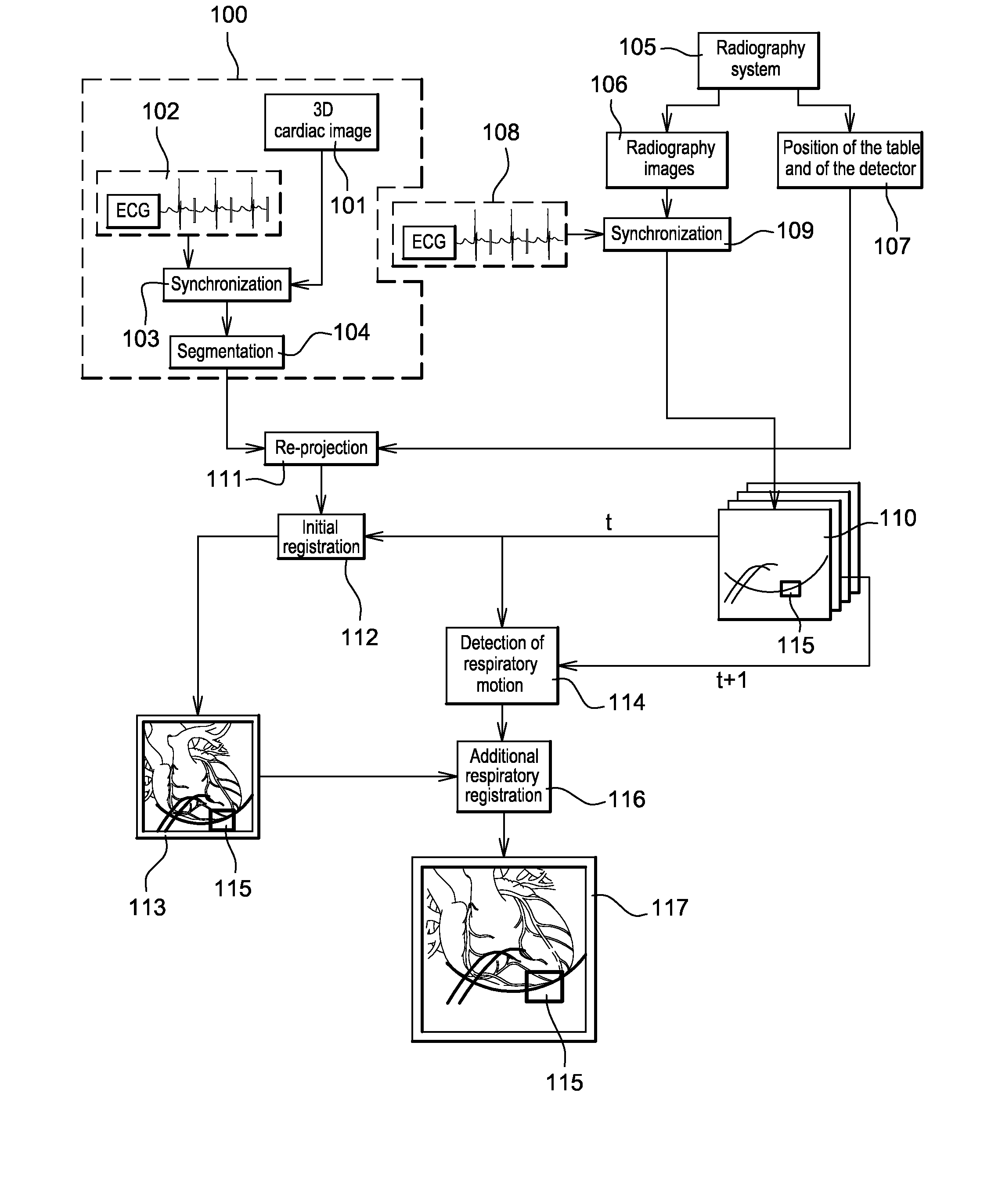 Method of detection and compensation for respiratory motion in radiography cardiac images synchronized with an electrocardiogram signal