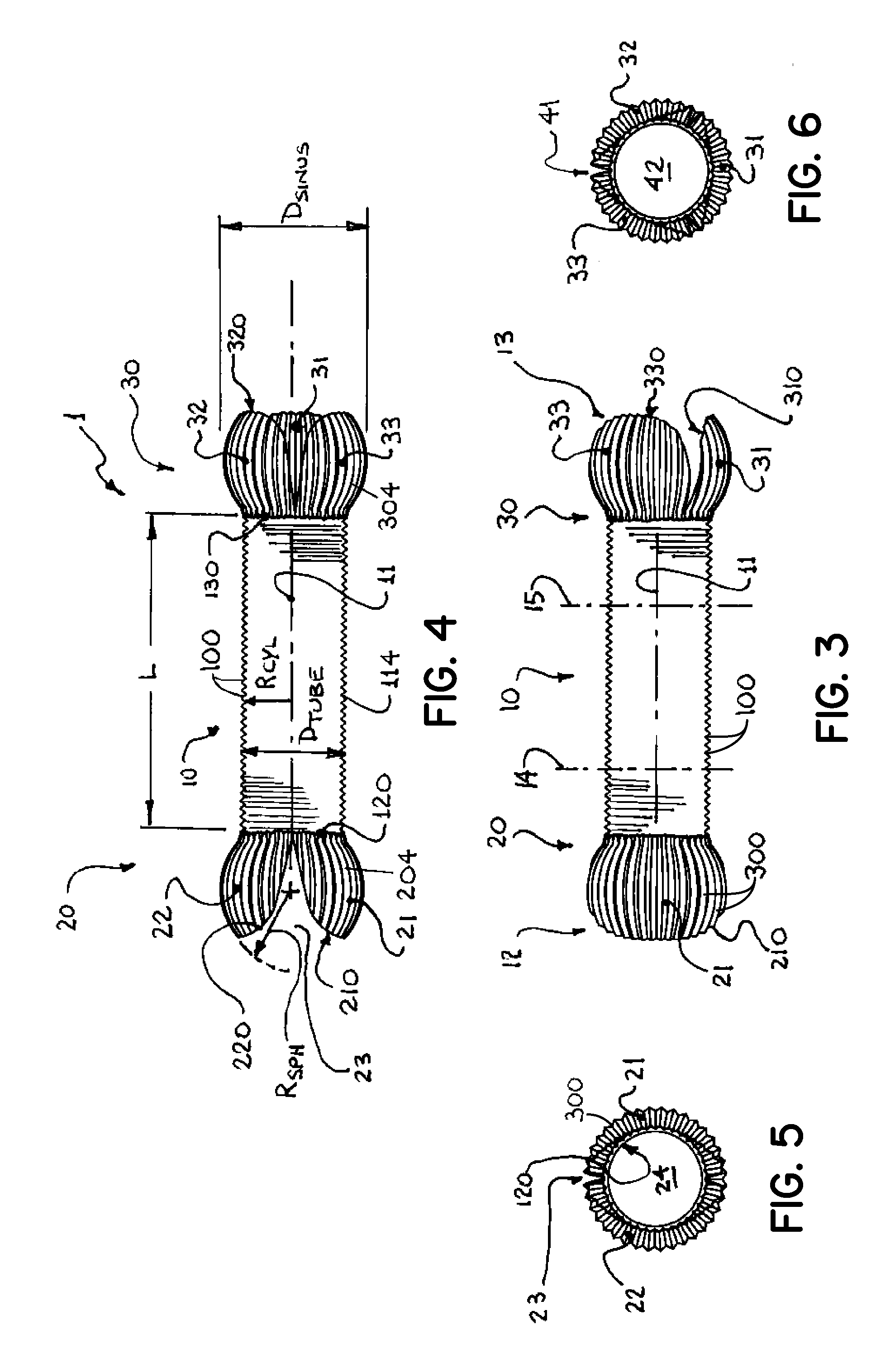 Aortic conduit configured with terminal ends having neosinuses of valsalva