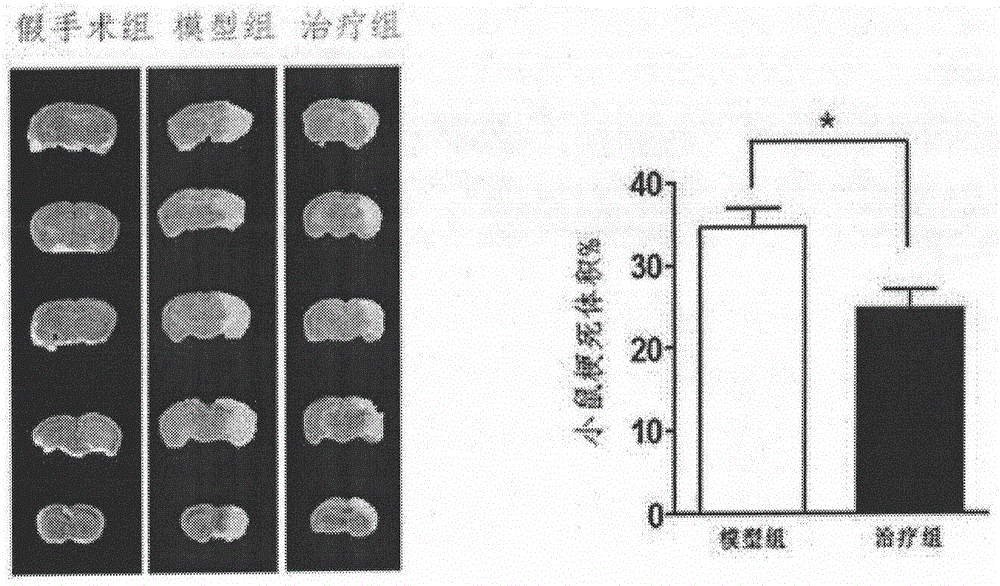 Application of domperidone in preparation of therapeutics for cerebral ischemia-reperfusion injury