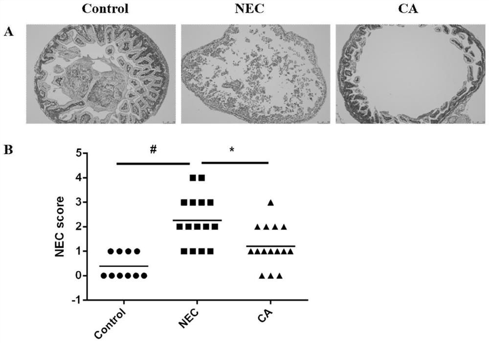 Application of coniferyl aldehyde in preparation of medicine for treating neonatal necrotizing enterocolitis