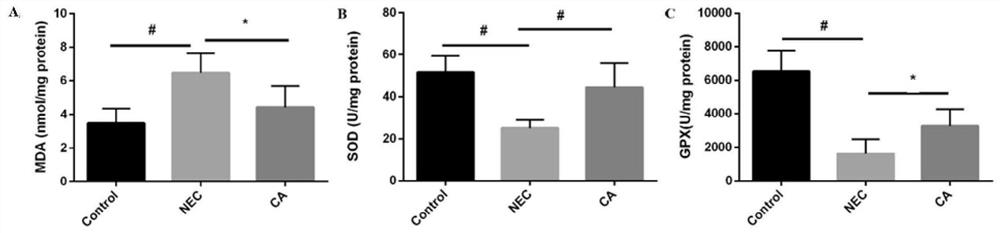 Application of coniferyl aldehyde in preparation of medicine for treating neonatal necrotizing enterocolitis