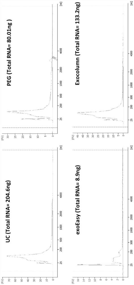 Biomarkers and detection kits for bladder cancer diagnosis and recurrence monitoring