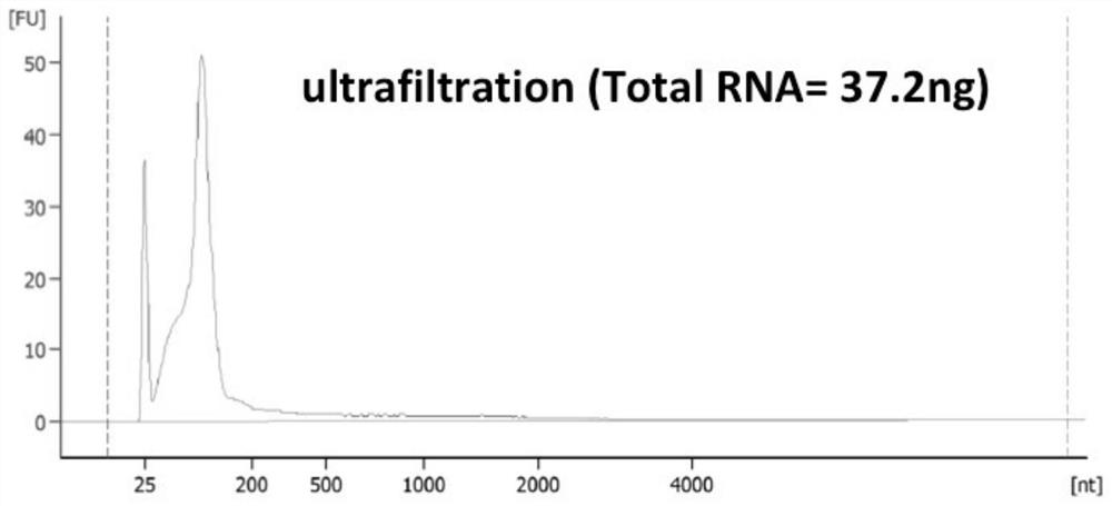 Biomarkers and detection kits for bladder cancer diagnosis and recurrence monitoring