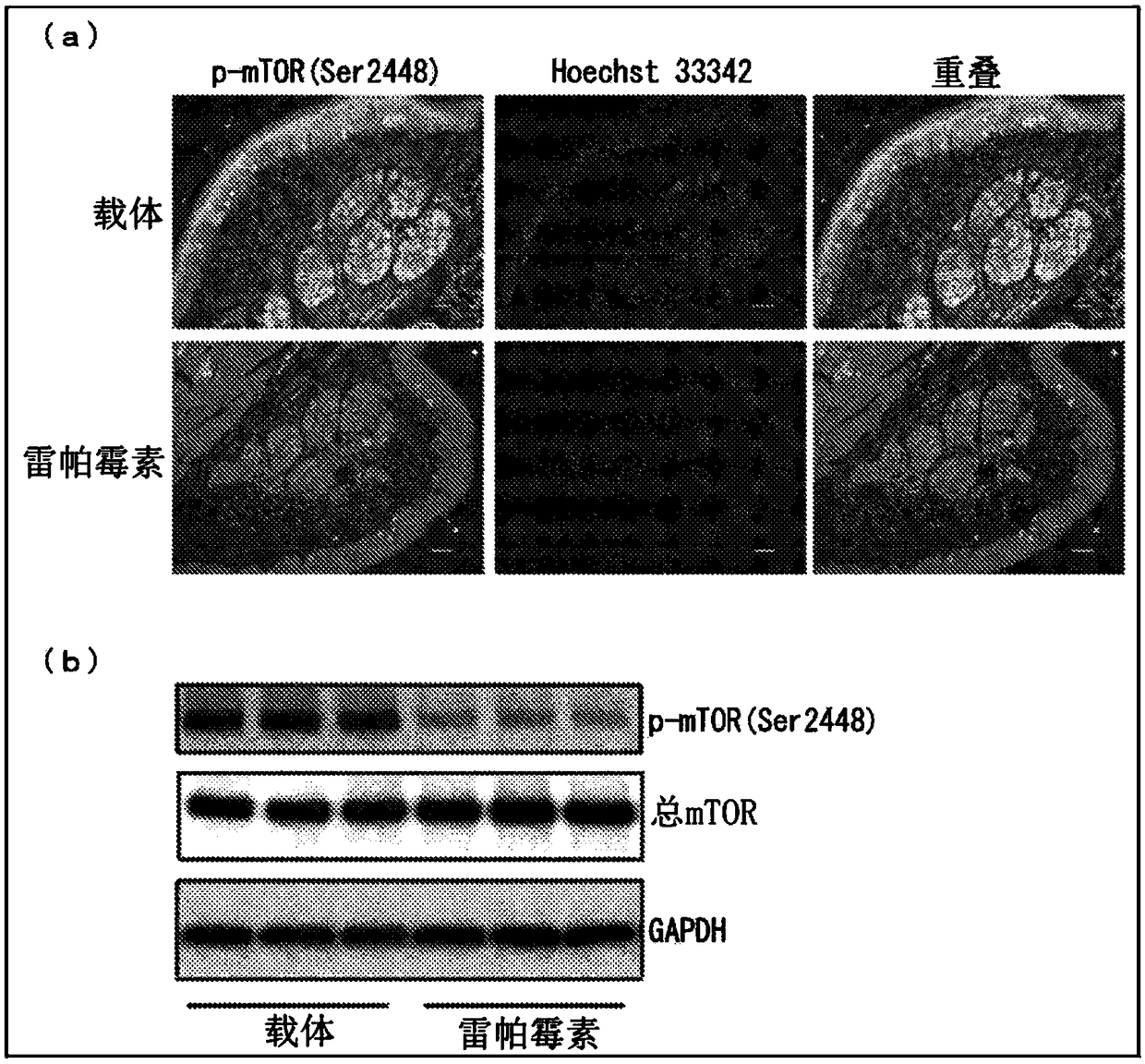 Agent for treating fabry disease, analgesic for external use and perspiration accelerator