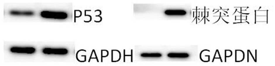 Modified FBXW7 circular RNA and application thereof in tumor drugs and new crown vaccines