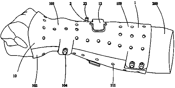 External Fixation Scaffold Components to Promote Bone Healing