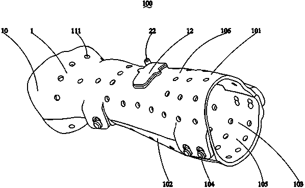 External Fixation Scaffold Components to Promote Bone Healing