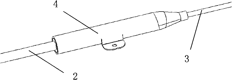 Extension wire protective sleeve of implanted nerve electrical stimulation system