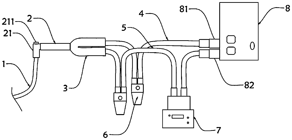 Off-line system under oxygen therapy mode of patient suffering from tracheal intubation