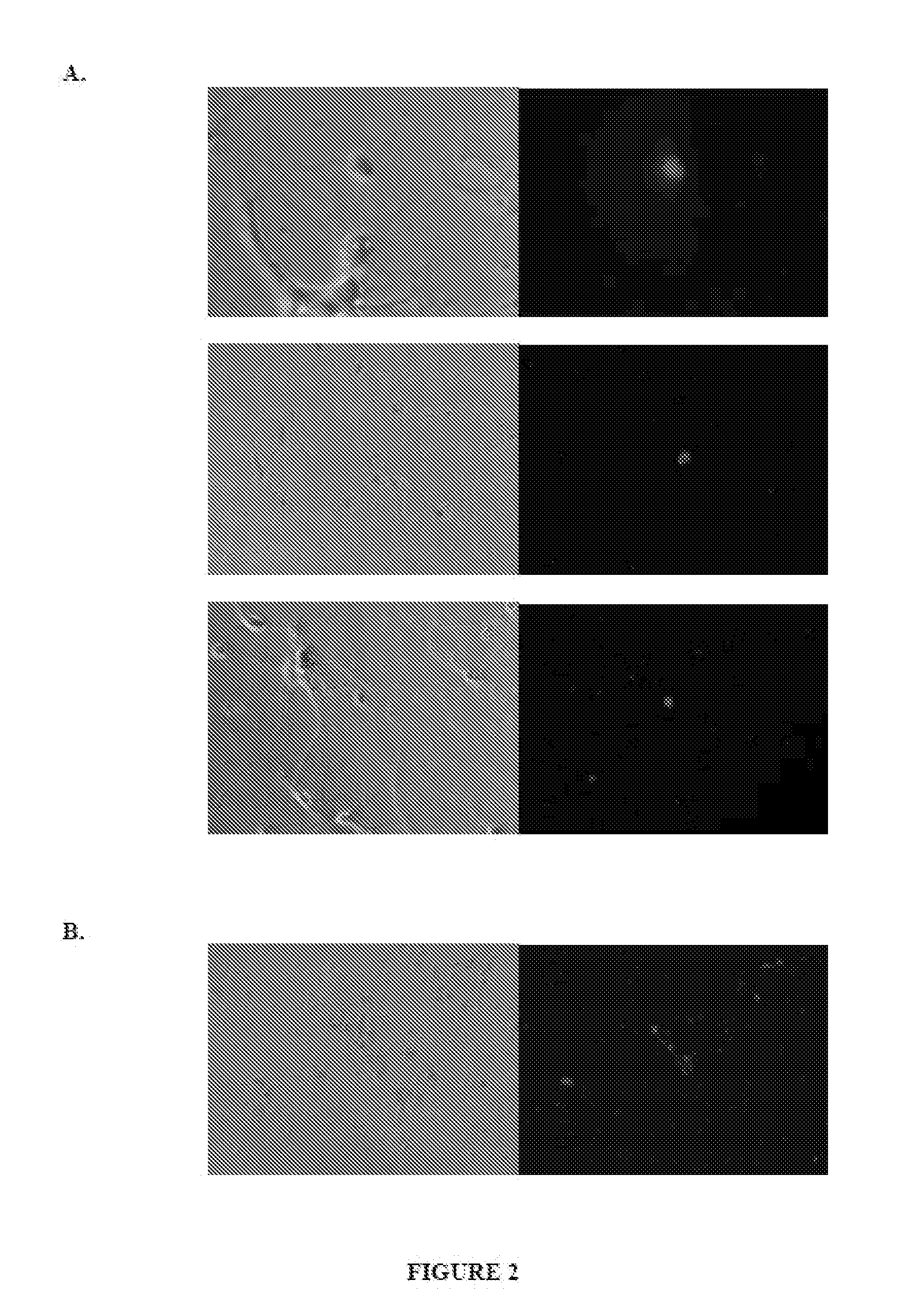 Neural transfection reagents