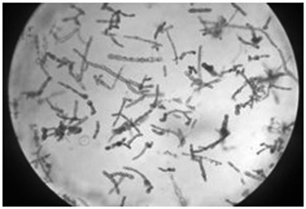 Fast degerming method in process of conventional culture of kelp gametophyte cloning