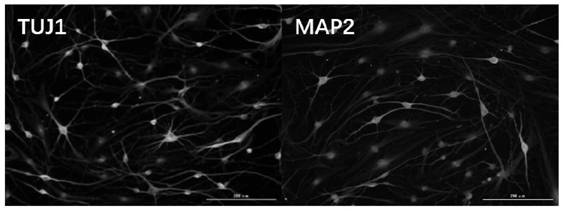 Method for efficiently inducing human cells to be reprogrammed into neuronal cells