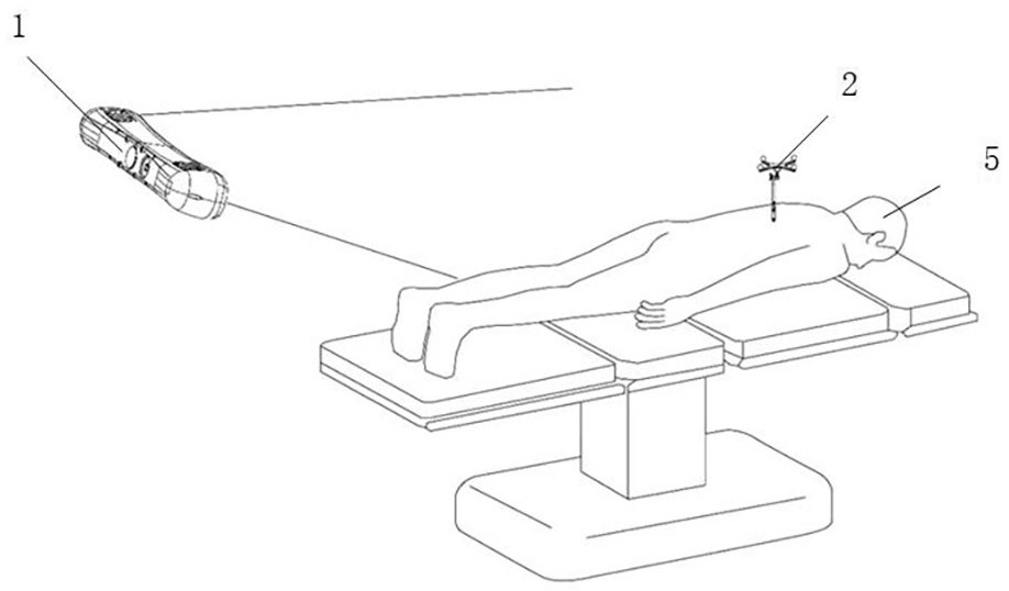 Human body tracking arrangement system and method for minimally invasive surgery