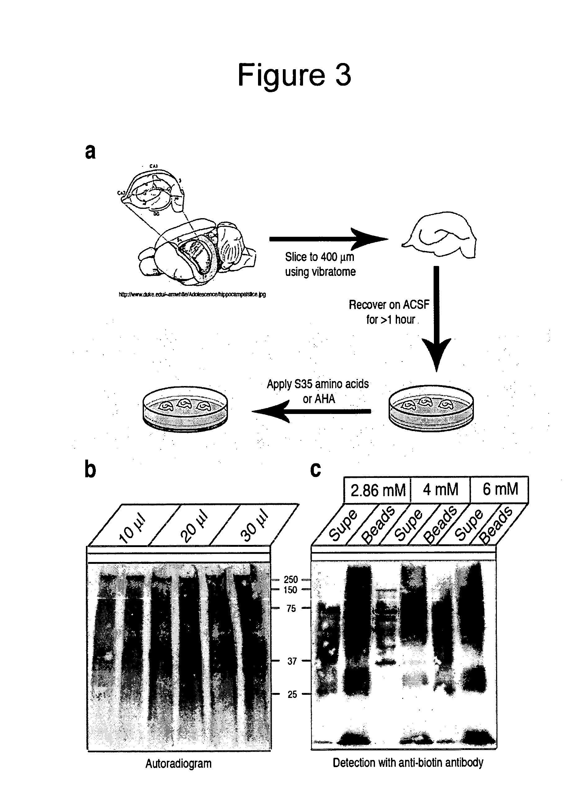 Use of non-canonical amino acids as metabolic markers for rapidly-dividing cells