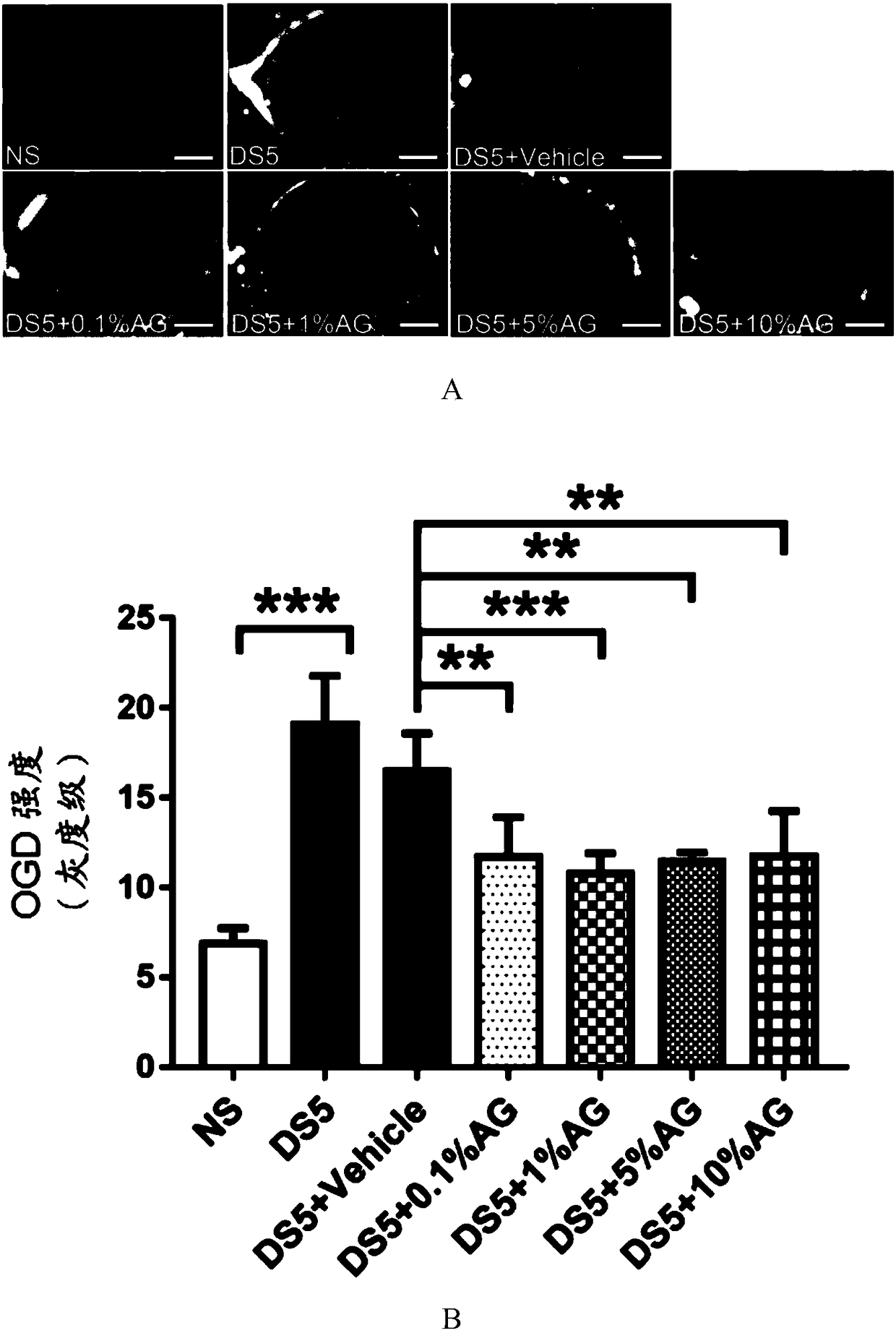 Ophthalmic drug combination and preparation and application methods thereof