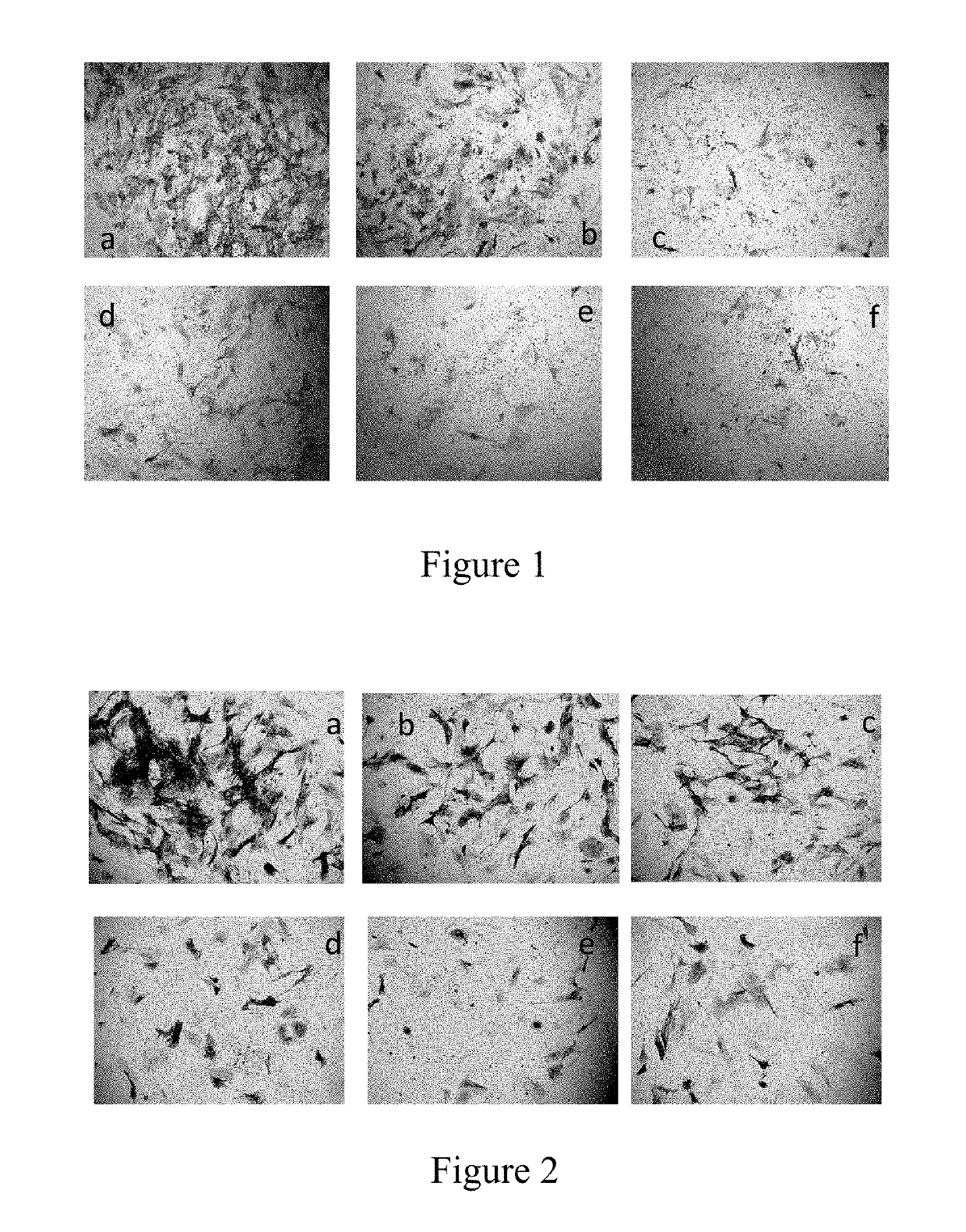 Compositions and methods for preventing and treating heterotopic ossification and pathologic calcification