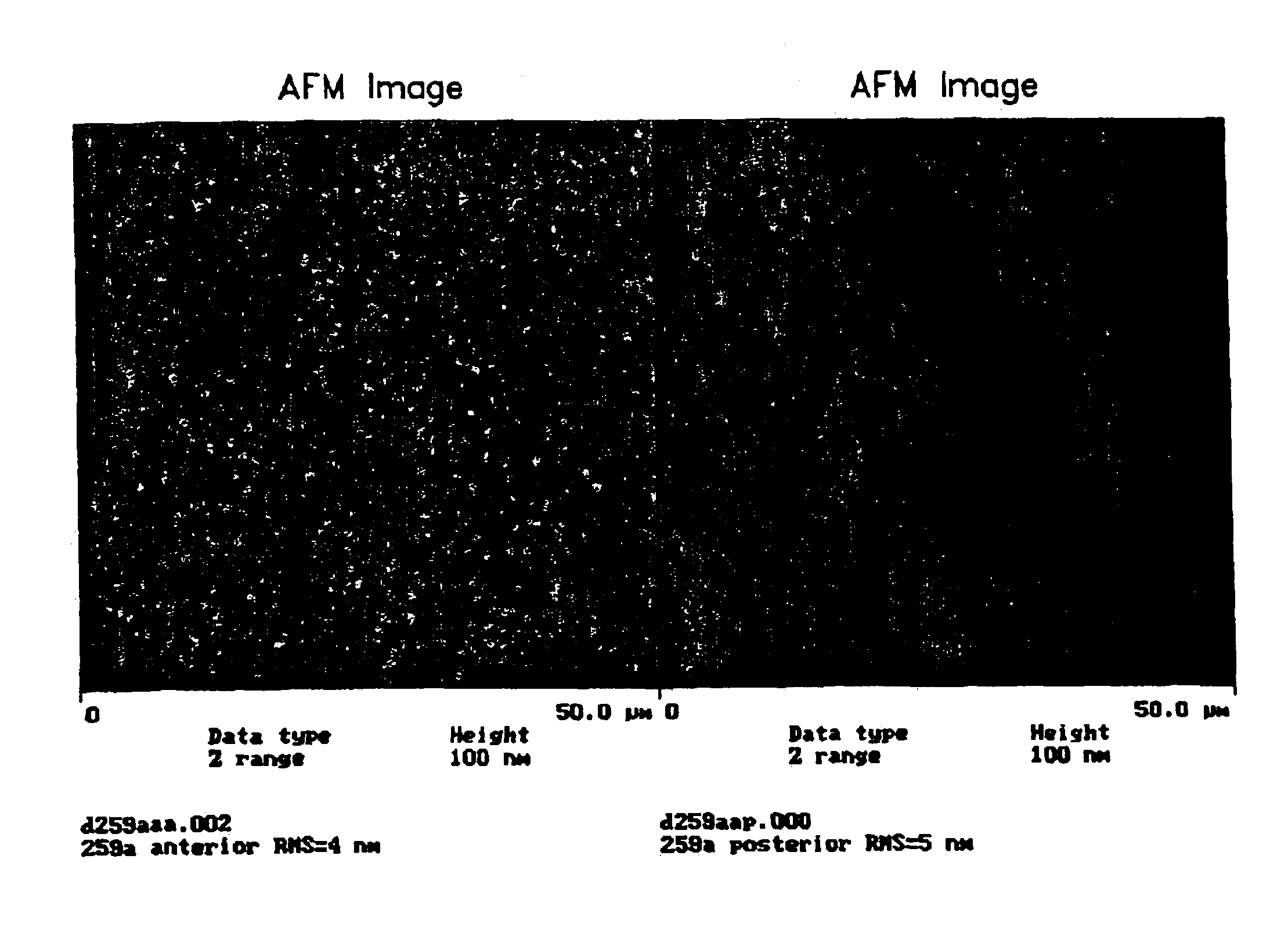 Surface treatment for silicone hydrogel contact lenses comprising hydrophilic polymer chains attached to an intermediate carbon coating